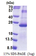 3?g Human DUSP26 protein (GTX68714-pro) by SDS-PAGE under reducing condition and visualized by coomassie blue stain.