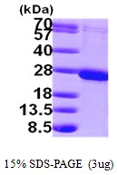 3?g Human RAB1B protein (GTX68774-pro) by SDS-PAGE under reducing condition and visualized by coomassie blue stain.