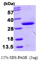 3?g Human HDHD3 protein (GTX68777-pro) by SDS-PAGE under reducing condition and visualized by coomassie blue stain.