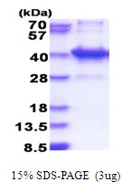 3?g Human AMMECR1L protein (GTX68782-pro) by SDS-PAGE under reducing condition and visualized by coomassie blue stain.