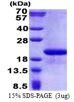 3?g Human FAM107B protein (GTX68783-pro) by SDS-PAGE under reducing condition and visualized by coomassie blue stain.