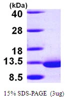 3?g Human DYNLRB1 protein (GTX68785-pro) by SDS-PAGE under reducing condition and visualized by coomassie blue stain.