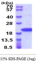 3?g Rat nm23-H2 protein (GTX68790-pro) by SDS-PAGE under reducing condition and visualized by coomassie blue stain.