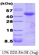 3?g Human Dysbindin protein (GTX68795-pro) by SDS-PAGE under reducing condition and visualized by coomassie blue stain.