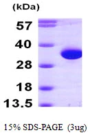 3?g Human HDHD2 protein (GTX68796-pro) by SDS-PAGE under reducing condition and visualized by coomassie blue stain.