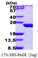 3?g Human ARL6 protein (GTX68797-pro) by SDS-PAGE under reducing condition and visualized by coomassie blue stain.