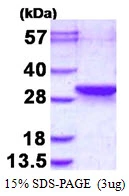 3?g Human LDOCL protein (GTX68800-pro) by SDS-PAGE under reducing condition and visualized by coomassie blue stain.