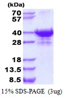 3?g Human UTP23 protein (GTX68803-pro) by SDS-PAGE under reducing condition and visualized by coomassie blue stain.