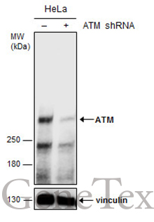 atm antibody 2c1