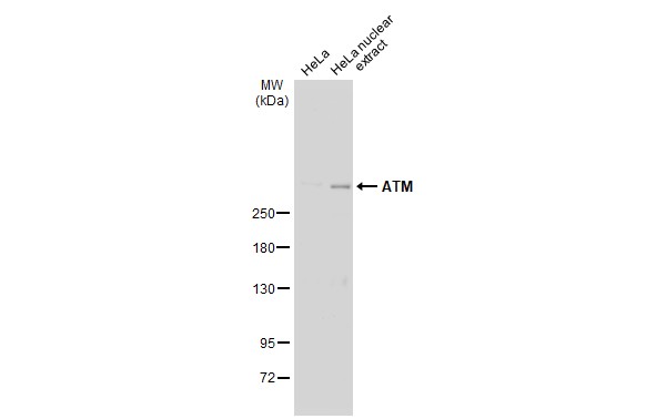 HeLa whole cell and nuclear extracts (30 ug) were separated by 5% SDS-PAGE,and the membrane was blotted with ATM antibody [2C1] (GTX70103) diluted at 1:1000.The HRP-conjugated anti-mouse IgG antibody (GTX213111-01) was used to detect the primary antibody.