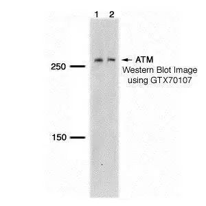 HeLa whole cell and nuclear extracts (30 ug) were separated by 5% SDS-PAGE,and the membrane was blotted with ATM antibody [5C2] (GTX70107) diluted at 1:1000.