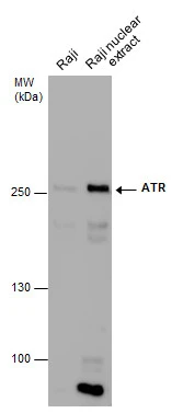 Raji whole cell and nuclear extracts (30 μg) were separated by 5% SDS-PAGE, and the membrane was blotted with ATR antibody (GTX70109) diluted at 1:500. The HRP-conjugated anti-mouse IgG antibody (GTX213111-01) was used to detect the primary antibody.