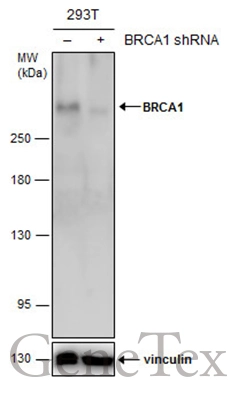 Non-transfected (–) and transfected (+) 293T whole cell extracts (60 μg) were separated by 5% SDS-PAGE, and the membrane was blotted with BRCA1 antibody [8F7] (GTX70113) diluted at 1:500. The HRP-conjugated anti-mouse IgG antibody (GTX213111-01) was used to detect the primary antibody.