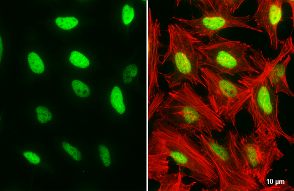 DNA ligase I antibody [10H5] detects DNA ligase I protein at nucleus by immunofluorescent analysis. Sample: HeLa cells were fixed in 4% paraformaldehyde at RT for 15 min. Green: DNA ligase I stained by DNA ligase I antibody [10H5] (GTX70141) diluted at 1:500. Red: phalloidin, a cytoskeleton marker, diluted at 1:200. Scale bar= 10 μm.