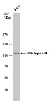 DNA ligase III detects DNA ligase III antibody [1F3] protein by western blot analysis.