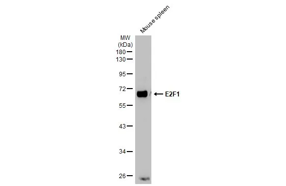 Mouse tissue extract (50 μg) was separated by 10% SDS-PAGE, and the membrane was blotted with E2F1 antibody [17E2] (GTX70154) diluted at 1:1000. The HRP-conjugated anti-mouse IgG antibody (GTX213111-01) was used to detect the primary antibody.