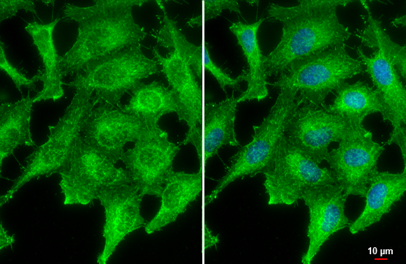 PNPase antibody [4C11] detects PNPase protein at cell junction by immunofluorescent analysis. Sample: HeLa cells were fixed in 4% paraformaldehyde at RT for 15 min. Green: PNPase stained by PNPase antibody [4C11] (GTX70159) diluted at 1:500. Blue: Fluoroshield with DAPI (GTX30920). Scale bar= 10μm.