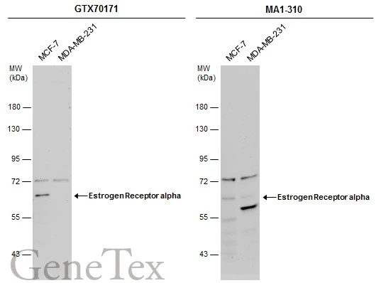 Non-transfected (�) and transfected (+) 293T whole cell extracts (30 ug) were separated by 7.5% SDS-PAGE,and the membrane was blotted with Estrogen Receptor alpha antibody [1F3] (GTX70171) diluted at 1:5000.