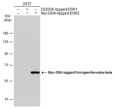 Estrogen Receptor beta antibody [4D2]