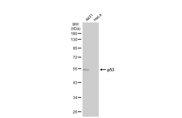 p53 antibody [Pab1801]
