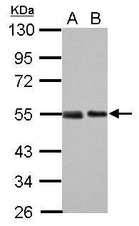 Sample (30 ug of whole cell lysate) A: 293T B: A431 10% SDS PAGE GTX70218 diluted at 1:1000 The HRP-conjugated anti-mouse IgG antibody (GTX213111-01) was used to detect the primary antibody.