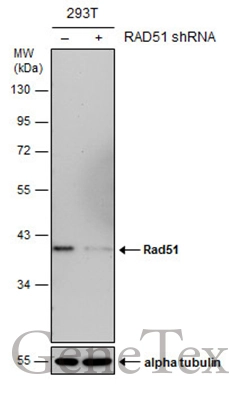 Anti-Rad51 antibody [14B4] (GTX70230) | GeneTex