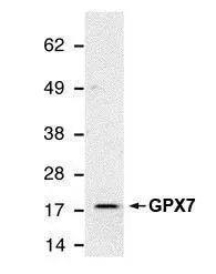 Detection of GPX7 using GPX7 antibody [2704] (GTX70266) in HeLa whole cell extract.