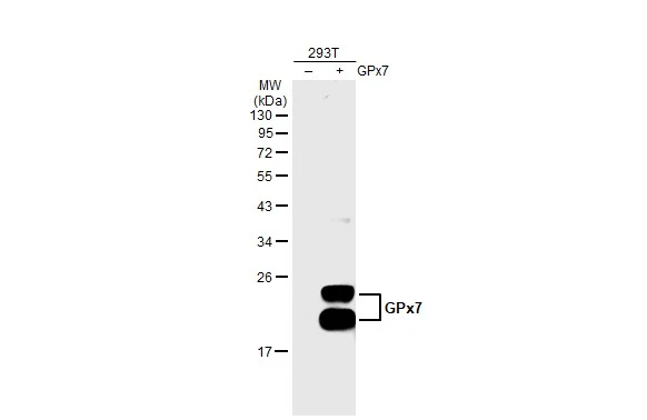 Non-transfected (–) and transfected (+) 293T whole cell extracts (30 μg) were separated by 12% SDS-PAGE, and the membrane was blotted with GPX7 antibody [2704] (GTX70266) diluted at 1:500 The HRP-conjugated anti-mouse IgG antibody (GTX213111-01) was used to detect the primary antibody.