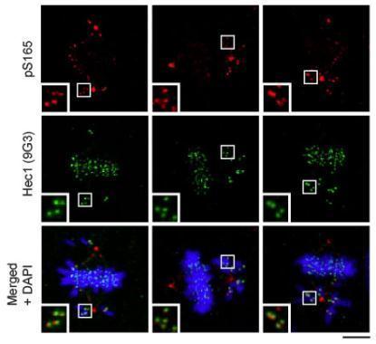 Whole cell extract (30 ug) was separated by 7.5% SDS-PAGE,and the membrane was blotted with HEC1 antibody [9G3.23] (GTX70268) diluted at 1:1000. The signal was developed with Trident ECL plus-Enhanced.