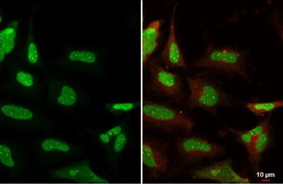 Ku80 antibody [9403]