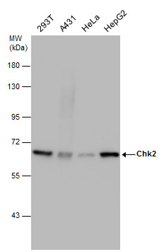 Immunofluorescence analysis of paraformaldehyde-fixed HeLa,using (GTX70295) antibody at 1:500 dilution.