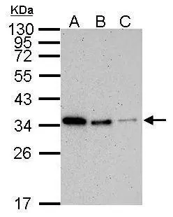 Sample (30 ug of whole cell lysate) A: Jurkat B: Raji C: 293T D: A431 E: HeLa F: HepG2 G: H1299 H: HCT116 I: MCF-7 J: NT2D1 K: PC-3 L: U87-MG 12% SDS PAGE GTX70298 diluted at 1:1000 