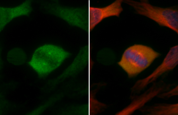 Chk1 antibody [6F5] detects Chk1 protein at centrosome by immunofluorescent analysis. Sample: HeLa cells were fixed in 4% paraformaldehyde at RT for 15 min. Green: Chk1 stained by Chk1 antibody [6F5] (GTX70303) diluted at 1:500. Red: beta Tubulin, a cytoskeleton marker, stained by beta Tubulin antibody (GTX101279) diluted at 1:1000. Blue: Fluoroshield with DAPI (GTX30920).
