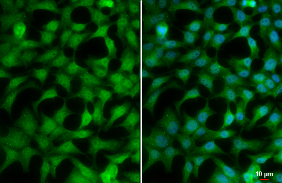 RAD54L antibody [60.1] detects RAD54L protein at cytoplasm and nucleus by immunofluorescent analysis. Sample: HeLa cells were fixed in 4% paraformaldehyde at RT for 15 min. Green: RAD54L stained by RAD54L antibody [60.1] (GTX70306) diluted at 1:500. Blue: Fluoroshield with DAPI (GTX30920). Scale bar= 10μm.