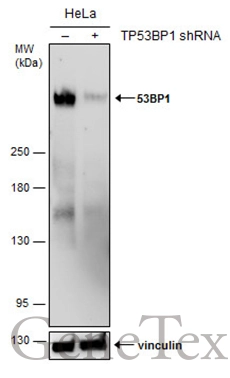 Non-transfected (–) and transfected (+) HeLa whole cell extracts (50 μg) were separated by 5% SDS-PAGE, and the membrane was blotted with 53BP1 antibody (GTX70310) diluted at 1:500. The HRP-conjugated anti-rabbit IgG antibody (GTX213110-01) was used to detect the primary antibody. Non-transfected (–) and transfected (+) HeLa whole cell extracts (50 μg) were separated by 5% SDS-PAGE, and the membrane was blotted with 53BP1 antibody (GTX70310) diluted at 1:500. The HRP-conjugated anti-rabbit IgG antibody (GTX213110-01) was used to detect the primary antibody.