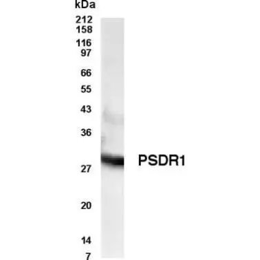 Western blot analysis of human PSDR1 in androgen-stimulated metastatic adenocarcinoma LNCaP.FGC cell lysate.