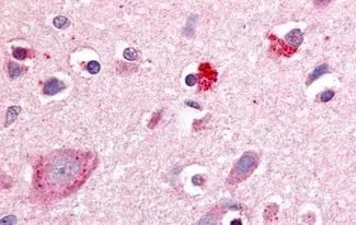 Immunohistochemical staining of human tissue sections using ROR beta antibody (GTX70903)