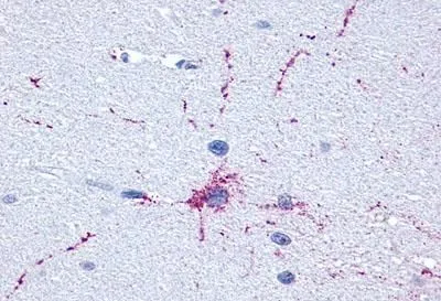 Brain,Neurons and glia
