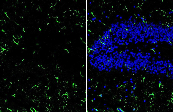 IL1 beta antibody detects IL1 beta protein by immunofluorescent analysis.