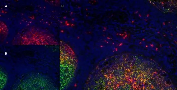 IHC-Fr image of human tonsil stained with Sheep anti Human LOX-1 antibody (GTX39812) in red and with Mouse anti Human CD21 antibody (GTX74728) in red. Nuclei are stained blue using DAPI. Merged image on right