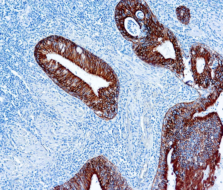 Formalin fixed paraffin embedded human tonsil stained with Cytokeratin (AE1 & AE3) antibody (cat. # GTX73583)