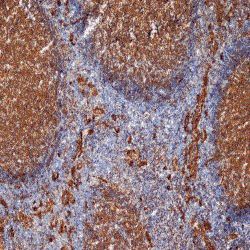 IHC-Fr analysis of human tonsil tissue using GTX76184 CD9 antibody [MM2/57].