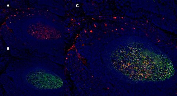 IHC-Fr staining of human tonsil using Mouse anti Human CD1a antibody (GTX76536. A in red) and Mouse anti Human CD21 (GTX74728. B in green). C is the merged image. High power