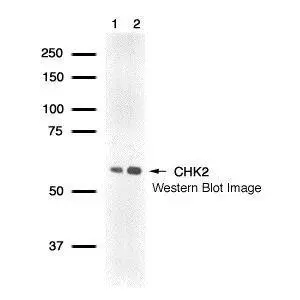 Detection of human CHK2 protein using GeneTex CHK2 polyclonal antiserum (GTX77609) in Molt4 whole cell lysate (lane 1) and Jurkat whole cell lysate (lane 2).