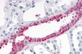 Immunohistochemical staining of human tissue sections using ADAMTS4 antibody (GTX78143)