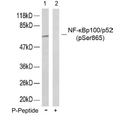 WB analysis of ovary cancer cell lysate using GTX79000 NFkB p100 (phospho Ser865) antibody.
