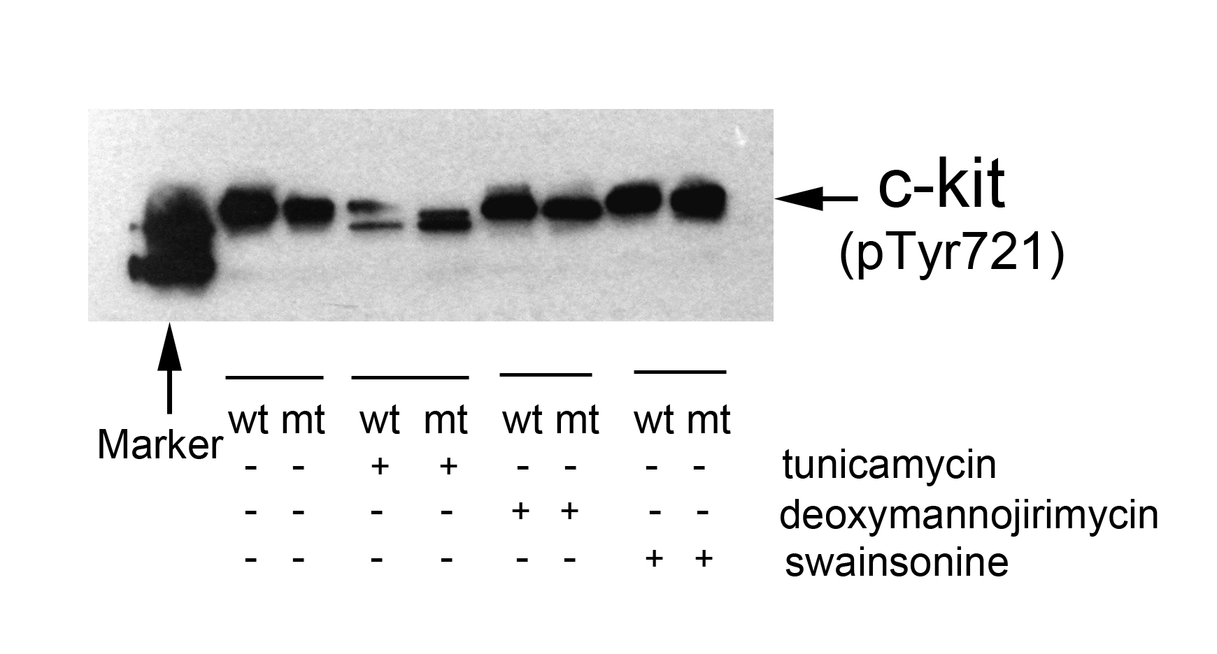 Extracts from 293T cells (transfected with wild or mutant type c-kit and treated with SCF (100ng/ml,15min),were analyzed by western blot using c-Kit (Phospho-Tyr721) antibody.