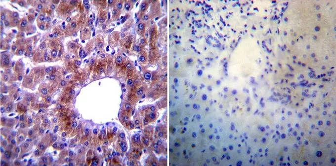 IHC-P analysis of human tonsil tissue with (left) or without (right) Heat Shock Protein 104 antibody [Antiserum 8-1] at a dilution of 1:100.