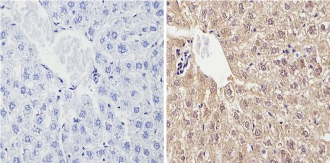 IHC-P analysis of rat liver tissue using GTX79174 Cytochrome P450 2C11 antibody. Right : Primary antibody Left : Negative control without primary antibody Antigen retrieval : 10mM sodium citrate (pH 6.0) microwaved for 8-15 min Dilution : 1:200