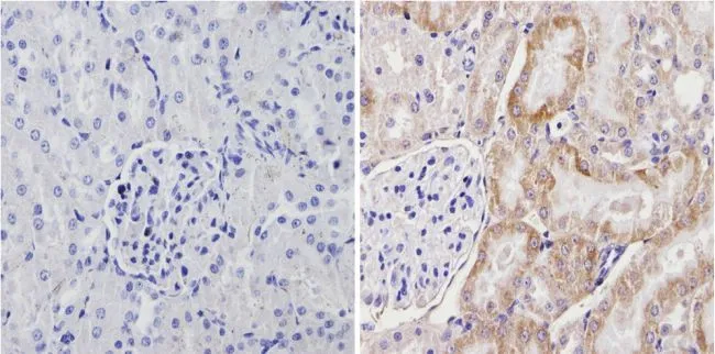 ICC/IF analysis of H-4-II-E cells using GTX79175 Cytochrome P450 4A antibody. Cells were probed without (left) or with(right) an antibody.